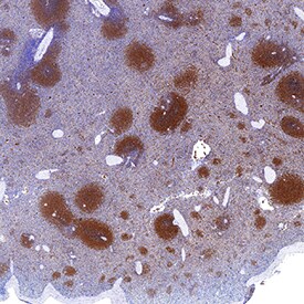 PKC beta 2 antibody in Human Spleen by Immunohistochemistry (IHC-P).