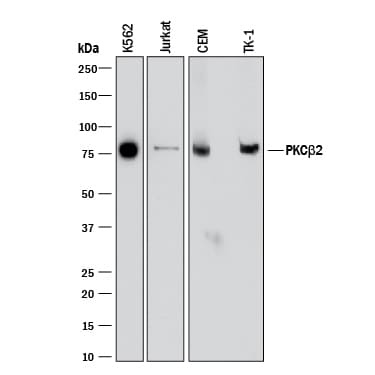 Detection of Human and Mouse PKC beta 2 antibody by Western Blot.
