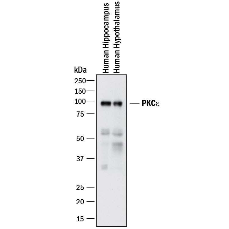 Detection of Human PKCe antibody by Western Blot.