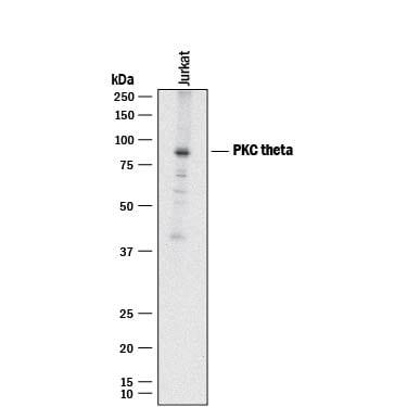 Detection of Human PKC? antibody by Western Blot.