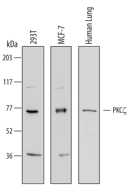 Detection of Human PKC? antibody by Western Blot.