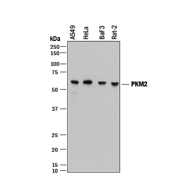 Detection of Human, Mouse, and Rat PKM2 antibody by Western Blot.