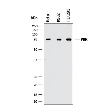 Detection of Human PKR antibody by Western Blot.