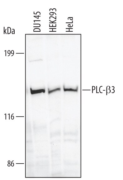Detection of Human PLC-beta 3 antibody by Western Blot.