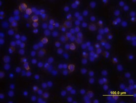PLC-?2 antibody in Human PBMCs by Immunocytochemistry (ICC).