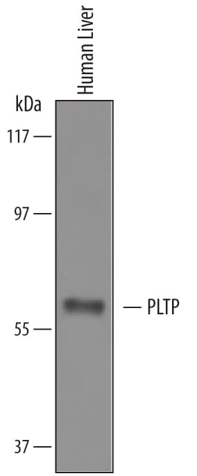 Detection of human PLTP antibody by Western Blot.