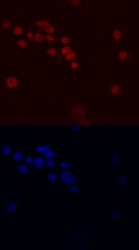PLZF antibody in HL-60 Human Cell Line by Immunocytochemistry (ICC).