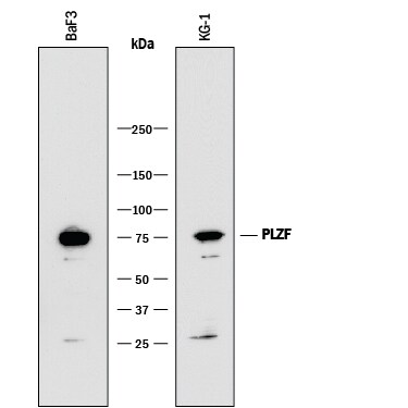 Detection of Human and Mouse PLZF antibody by Western Blot.