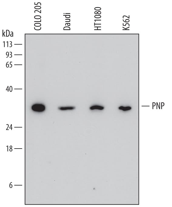 Detection of Human Purine Nucleoside Phosphorylase/PNP antibody by Western Blot.