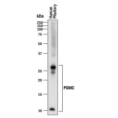 Detection of Human POMC antibody by Western Blot.