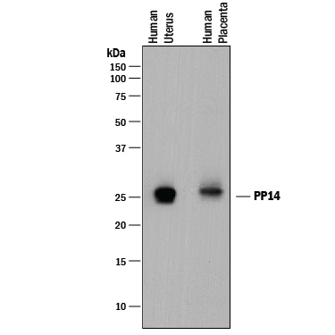 Detection of Human PP14/Glycodelin antibody by Western Blot.