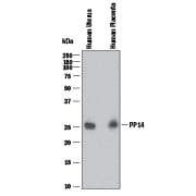 Detection of Human PP14/Glycodelin antibody by Western Blot.
