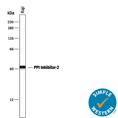 Detection of Human PP1 Inhibitor‑2 antibody by Simple WesternTM.