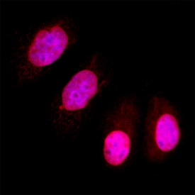 PPM1D antibody in MCF-7 Human Cell Line by Immunocytochemistry (ICC).