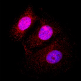 PPM1D antibody in MCF-7 Human Cell Line by Immunocytochemistry (ICC).
