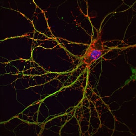 PPP1R9B antibody in Rat Neurons by Immunocytochemistry (ICC).