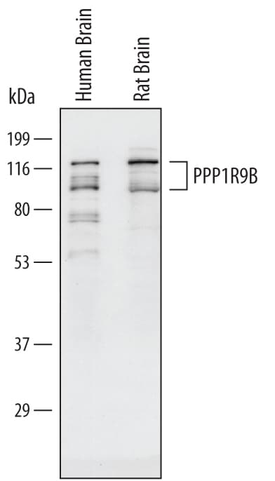 Detection of Human and Rat PPP1R9B antibody by Western Blot.