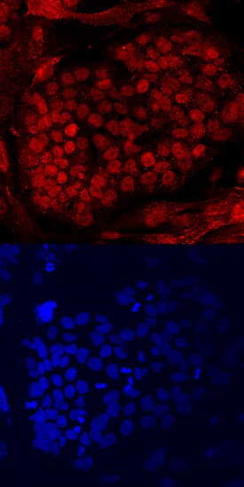 PRDM14 antibody in BG01V Human Cell Line by Immunocytochemistry (ICC).