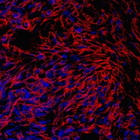 PRELP antibody in Human Mesenchymal Stem Cells by Immunocytochemistry (ICC).