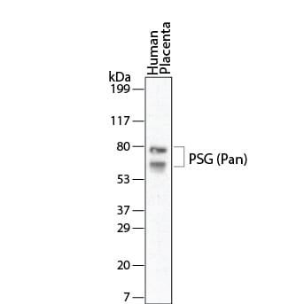 Detection of Human PSG antibody by Western Blot.
