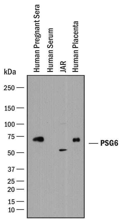Detection of Human PSG6 antibody by Western Blot.