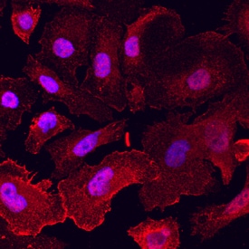 NAALADase I antibody in PC-3 Human Cell Line by Immunocytochemistry (ICC).