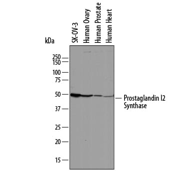 Detection of Human Prostaglandin I2 Synthase antibody by Western Blot.