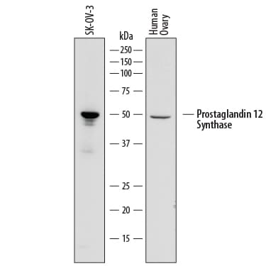 Detection of Human Prostaglandin I2 Synthase antibody by Western Blot.