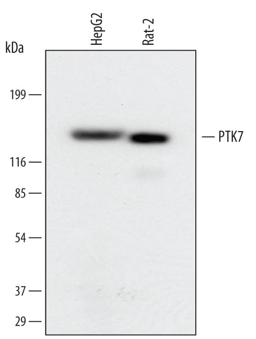 Detection of Human and Rat PTK7/CCK4 antibody by Western Blot.