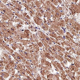 PTP1B antibody in Human Heart by Immunohistochemistry (IHC-P).