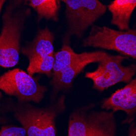 PUM1 antibody in HeLa Human Cell Line by Immunocytochemistry (ICC).