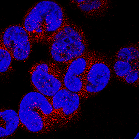 PVRIG antibody in MOLT-4 Human Cell Line by Immunocytochemistry (ICC).