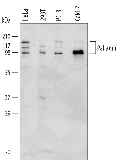 Detection of Human Palladin antibody by Western Blot.