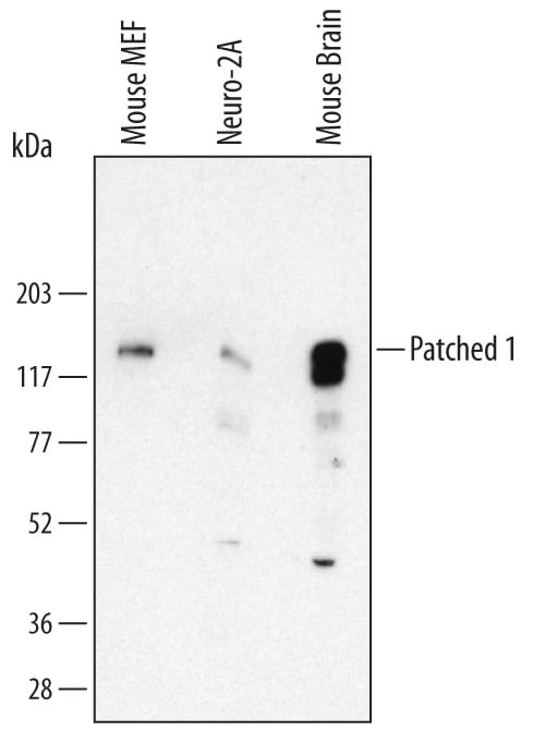 Detection of Mouse Patched 1/PTCH antibody by Western Blot.