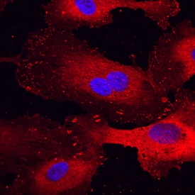 Paxillin antibody in HUVEC Human Cells by Immunocytochemistry (ICC).