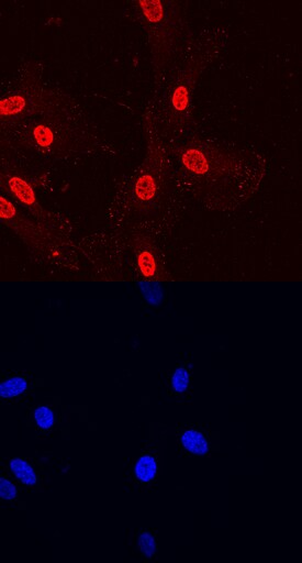 Paxillin antibody in HUVEC Human Cells by Immunocytochemistry (ICC).