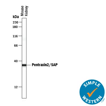 Detection of Mouse Pentraxin 2/SAP antibody by Simple WesternTM.