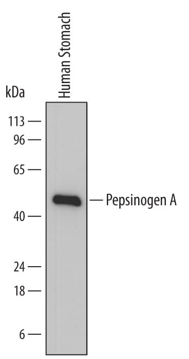 Detection of Human Pepsinogen A antibody by Western Blot.