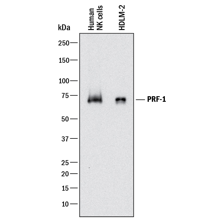 Detection of Human Perforin antibody by Western Blot.