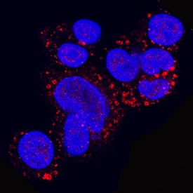 Perilipin-2 antibody in HepG2 Human Cell Line by Immunocytochemistry (ICC).