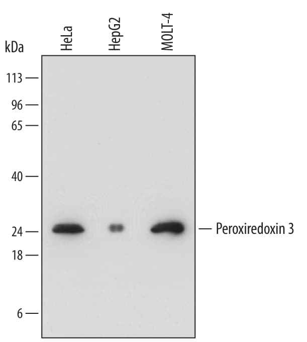 Detection of Human Peroxiredoxin 3 antibody by Western Blot.