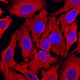Peroxiredoxin 4 antibody in HeLa Human Cell Line by Immunocytochemistry (ICC).