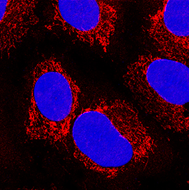 Peroxiredoxin 5 antibody in A549 Human Cell Line by Immunocytochemistry (ICC).