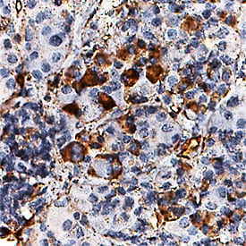 Pleiotrophin/PTN antibody in Human Pituitary by Immunohistochemistry (IHC-P).