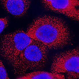 Pleiotrophin/PTN antibody in PC-3 Human Cell Line by Immunocytochemistry (ICC).