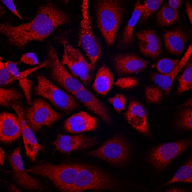 Pleiotrophin/PTN antibody in PC-3 Human Cell Line by Immunocytochemistry (ICC).