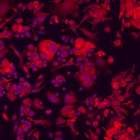 Plexin A1 antibody in Human Dendritic Cells by Immunocytochemistry (ICC).