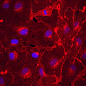 Plexin A2 antibody in bEnd by Immunocytochemistry (ICC).3 Mouse Cell Line by Immunocytochemistry (ICC).