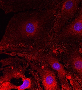 Plexin A2 antibody in bEnd by Immunocytochemistry (ICC).3 Mouse Cell Line by Immunocytochemistry (ICC).