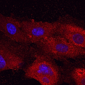 Plexin A2 antibody in HUVEC Human Cells by Immunocytochemistry (ICC).